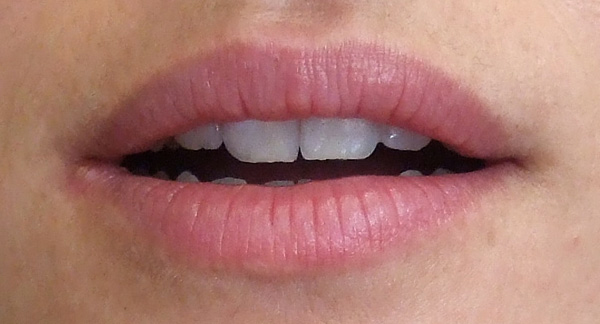 A close-up photo of a mouth.